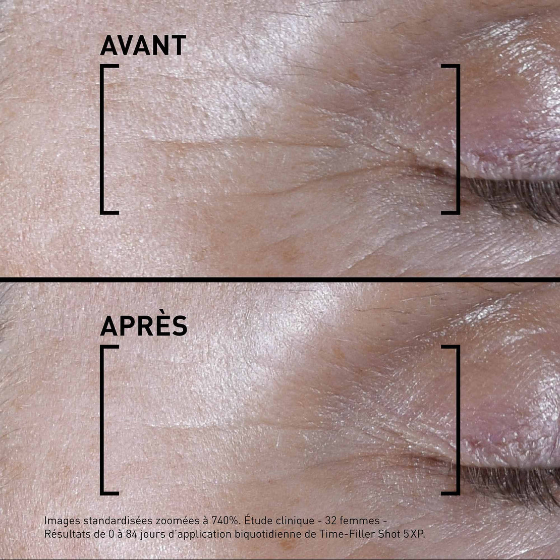 Filorga - Time-Filler Shot 5Xp Serum 15Ml 3