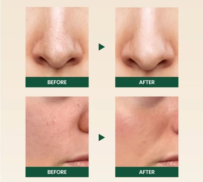 K-Secret - Seoul 1988 Cleansing Foam Pine Cica 1% + Probiotics 6
