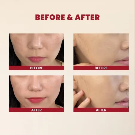 K-Secret - Seoul 1988 Essence Snail Mucin 97% + Rice 4