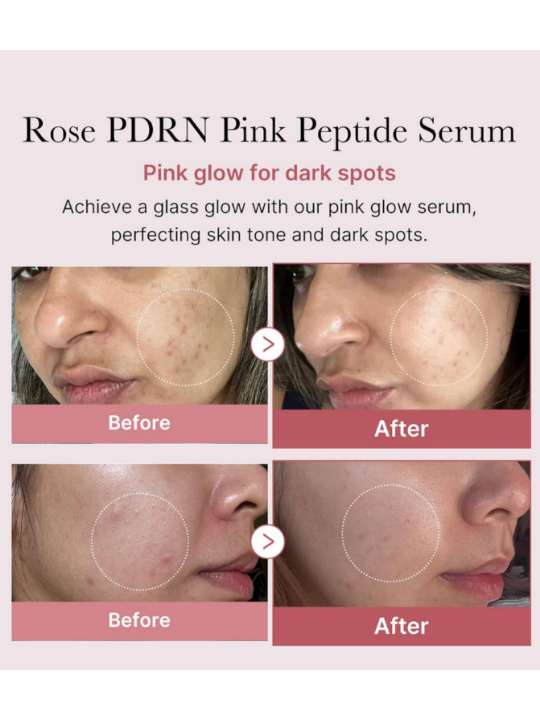 medicube - Pdrn Pink Peptide Serum 30Ml 4